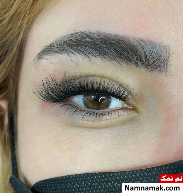 مضرات کاشت مژه