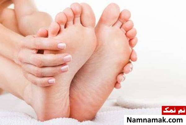 گر گرفتگی پا چه زمانی خطرناک است ؟