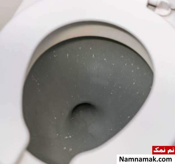 حال تهوع در هواپیما توالت هواپیما