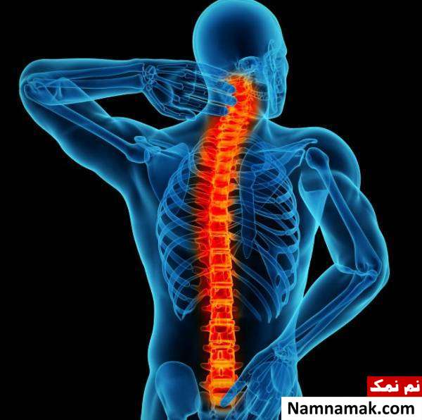 درد ستون فقرات علت درد ستون فقرات