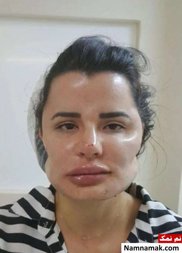 افتضاح پزشکی روی صورت بیماران 
