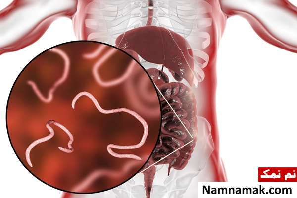 چیکار کنم انگلم از بین بره؟