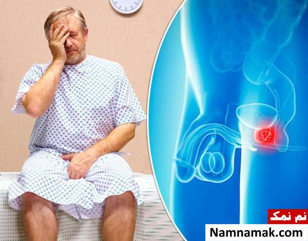 معجون درمان پروستات در طب سنتی
