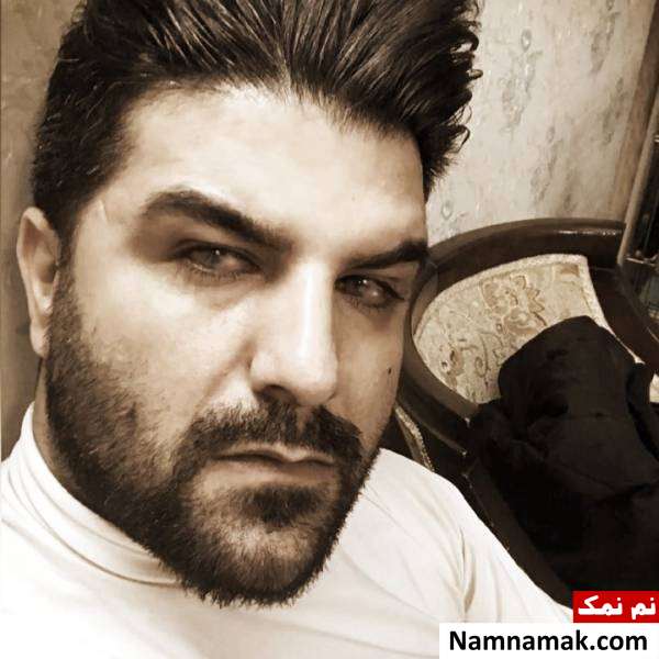 مجید خراطها بیماری چشمی مجید خراطها