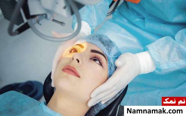 جراحی درمان انحراف چشم جراحی چشم ها