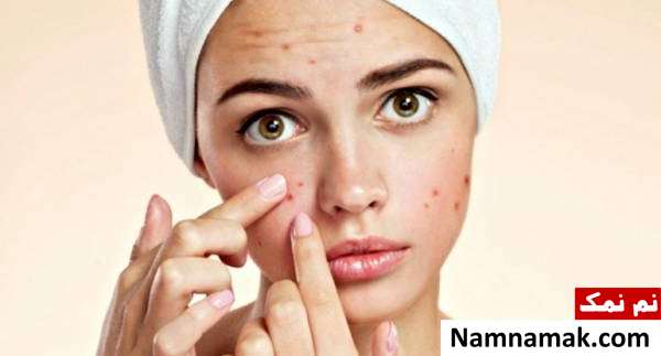 رژیم کتوژنیک برای رفع جوش