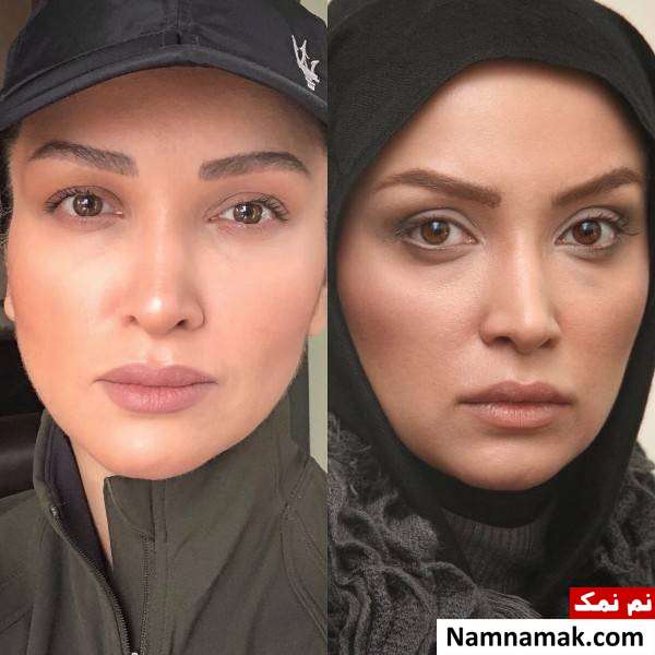 عکس 10 سال قبل و الان روناک یونسی