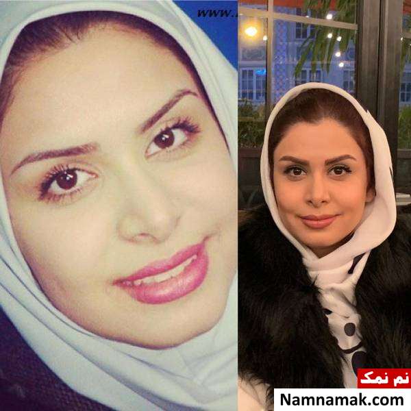 نجمه جودکی 10 سال قبل