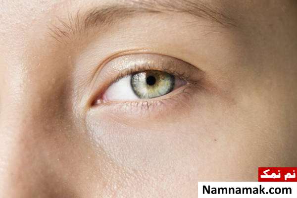 سکته چشم سکته چشم چیست؟