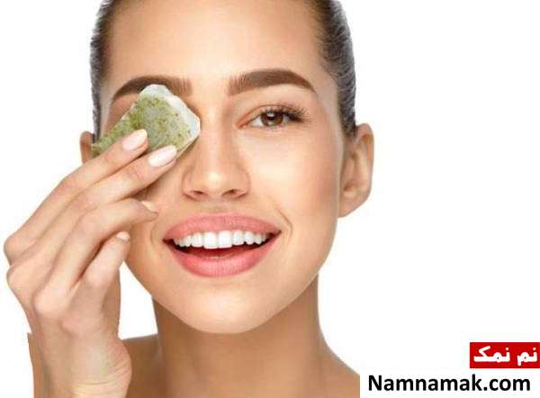 راه حل رفع کبودی زیر چشم