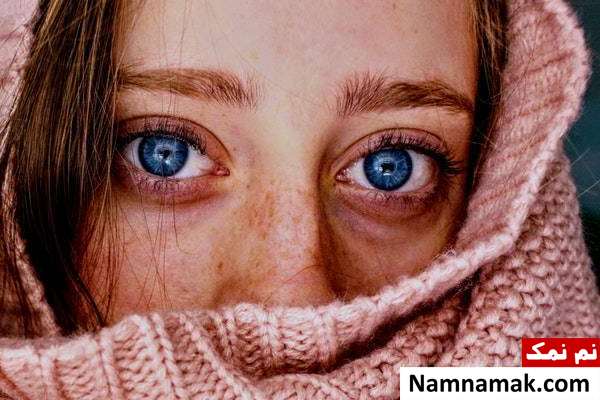 سیاهی زیر چشم تیرگی اطراف چشم