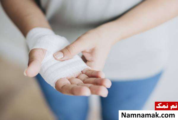 زخم دست دیر خوب شدن زخم ها