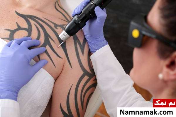 نکات تاتو تاتو و مسائل بهداشتی آن