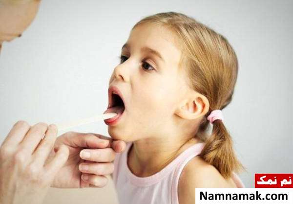 قرمزی زبان نشانه های بیماری مخملک