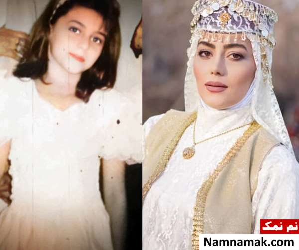 عکس هدیه بازوند قبل از عمل زیبایی عکس هدیه بازوند قبل از عمل زیبایی