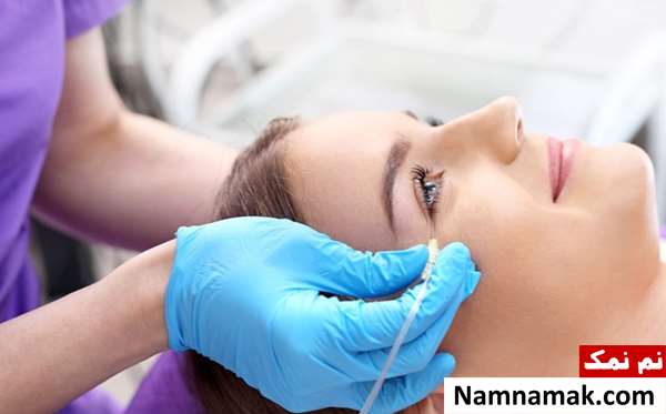 کربوکسی تراپی جای زخم و اسکار
