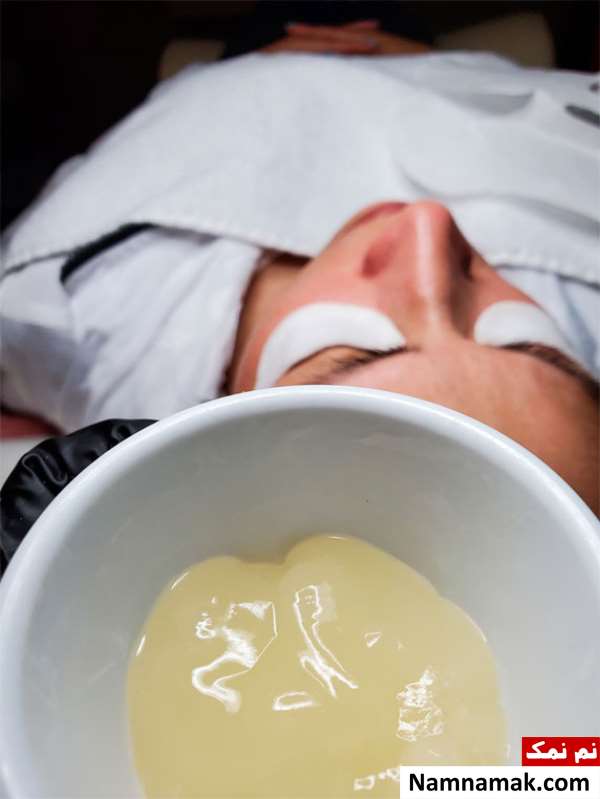 کربوکسی تراپی با مواد و ژل