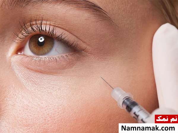 عوارض کربوکسی تراپی دور چشم