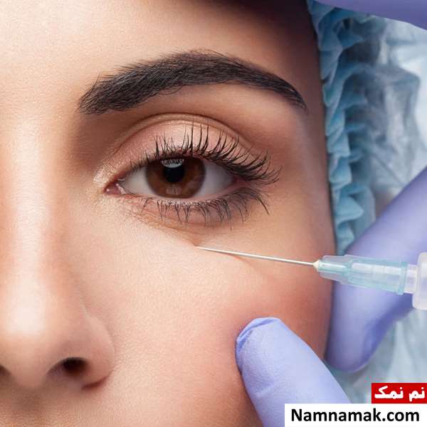 عوارض کربوکسی تراپی دور چشم