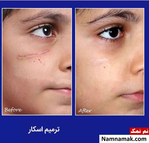 جراحی ترمیم زخم و اسکار