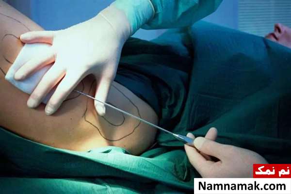 زشت ترین عمل های زیبایی در ایران و جهان