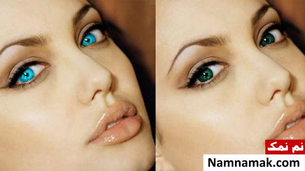 زشت ترین عمل های زیبایی در ایران و جهان