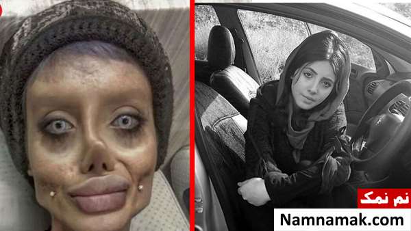 زشت ترین عمل های زیبایی در ایران و جهان