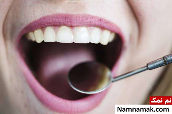 بیماری های لثه ارتباط دندان و قلب