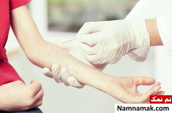 تشخیص آلرژی به حیوانات خانگی