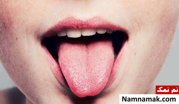 پرز های چشایی زبان حس چشایی افراد چاق و لاغر