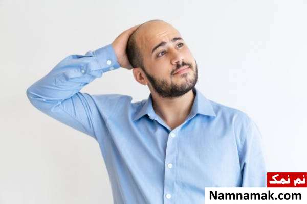 درمان طاسی سر با داروی گیاهی