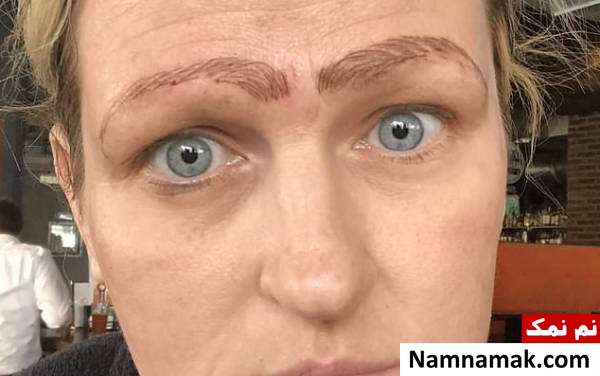 ابرو های عجیب زن 42 ساله