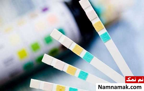 طریقه خواندن جواب آزمایش ادرار با تفسیر و جدول