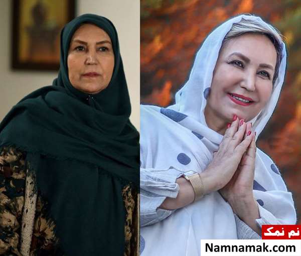 عکس مهوش صبرکن قبل و بعد از عمل زیبایی عکس مهوش صبرکن قبل و بعد از عمل زیبایی