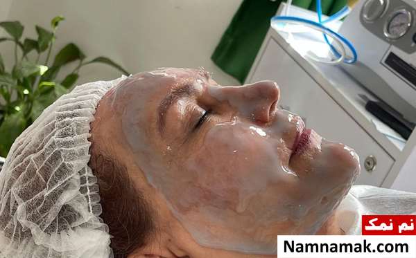 عکس مهوش صبرکن قبل و بعد از عمل زیبایی عکس مهوش صبرکن قبل و بعد از عمل زیبایی