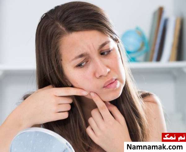 جوش زدن پوست صورت علائم چرب شدن پوست