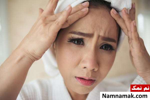 چرب شدن پوست از بین بردن جوش های سر سیاه