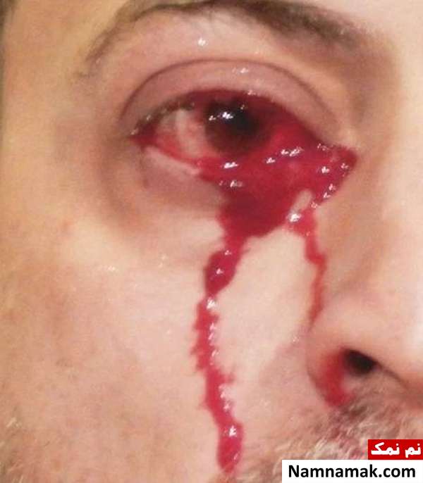 مرد ایتالیایی خون گریه کرد