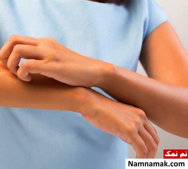 صابون گوگرد برای پوست صابون گوگرد برای بدن چه مضراتی دارد؟