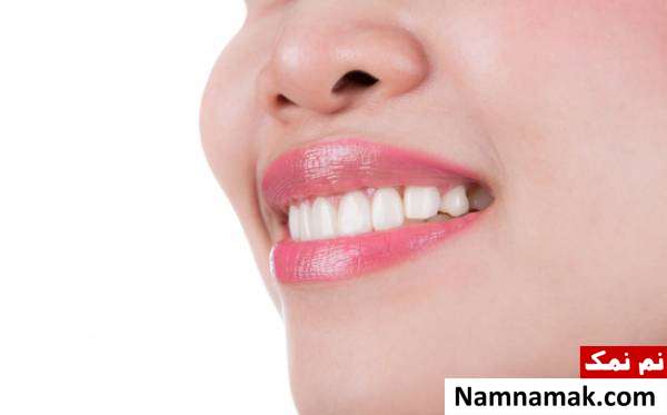 چه کنیم دندان هایمان سفید شوند؟