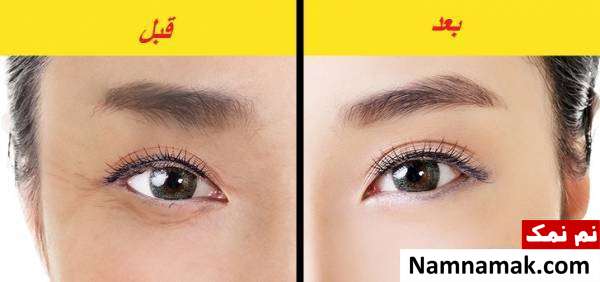 ماساژ شیاتسو رفع چروک دور چشم
