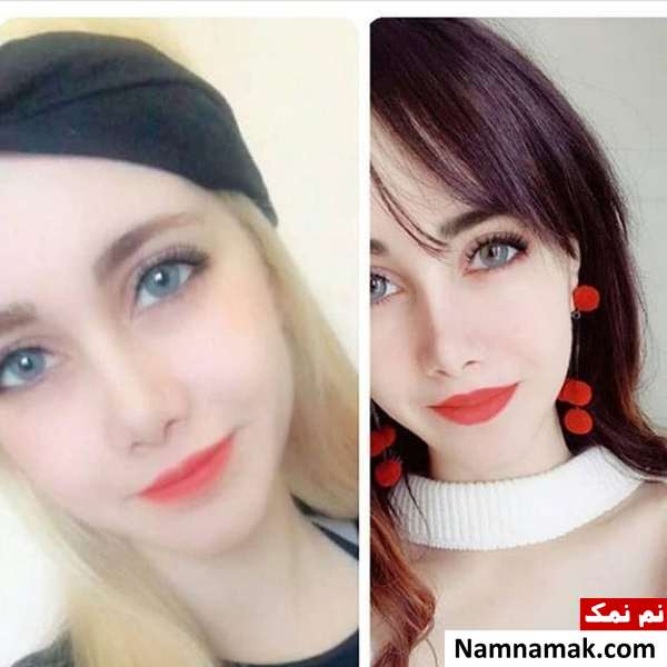 مراقبت های بعد از عمل بینی استخوانی رژیم غذایی بعد از عمل بینی استخوانی