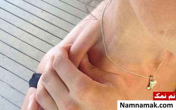 ماهیچه های ذوزنقه ای و درمان سردرد با ماساژ