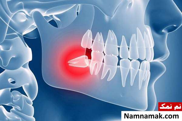 اعضای بی فایده بدن