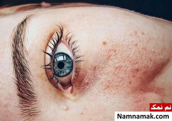 خال های خطرناک کدام هستند؟
