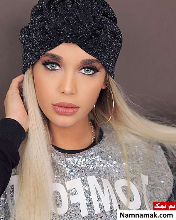 الهام گلرخ قبل و بعد از عمل زیبایی عمل جراحی زیبایی الهام گلرخ