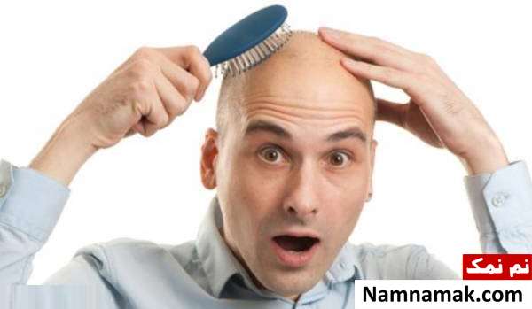 روش های کاشت مو بهترین روش کاشت مو