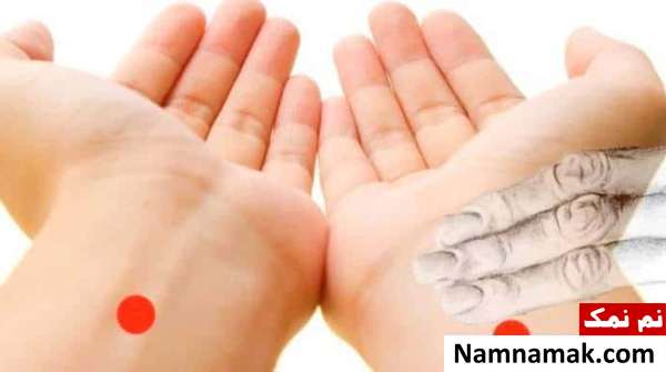 فشار روی مچ اعمال کردن فشار روی مچ برای درمان سرگیجه شدید