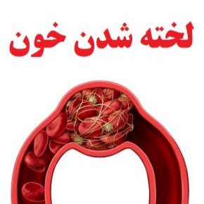 لخته شدن خون