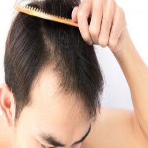 با رعایت این نکات شاهد رویش سریع و مجدد مو باشید